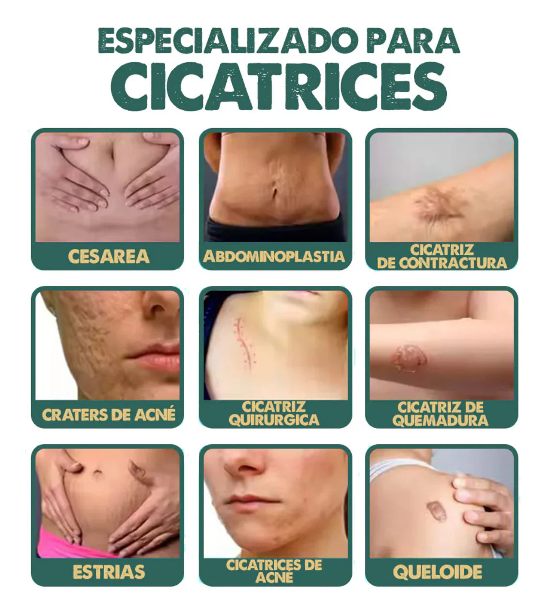 💥2x1 ⚡ SPRAY ANTI-CICATRICES™ 💫