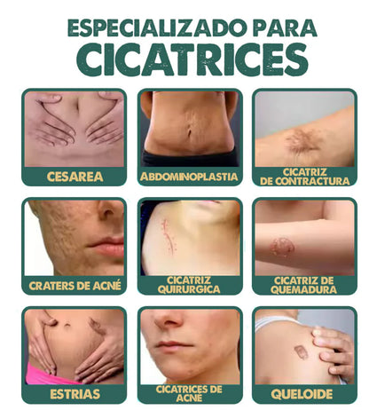 💥2x1 ⚡ SPRAY ANTI-CICATRICES™ 💫